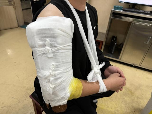 手被旋转木马卡骨折惊险瞬间！手被旋转木马卡住导致骨折，安全警示与应急处理指南